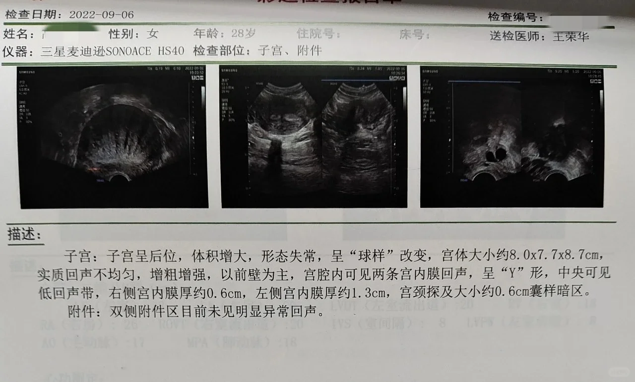 备孕不久发现子宫腔“一居室”变“两居室”,最好的代孕机构